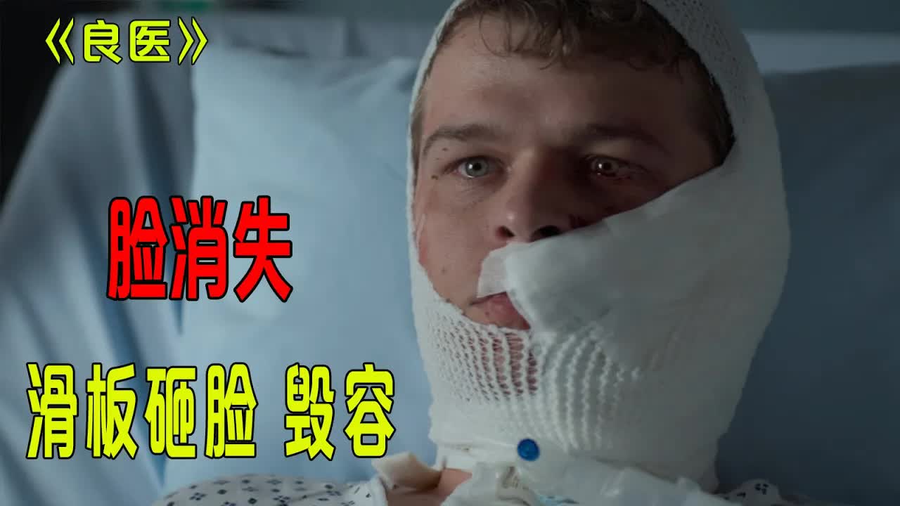 男生被滑板砸脸毁容，半张脸消失，天才医生和死神抢人！